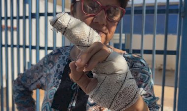 Ataque de Pitbull decepa parte do dedo de mulher em Marília